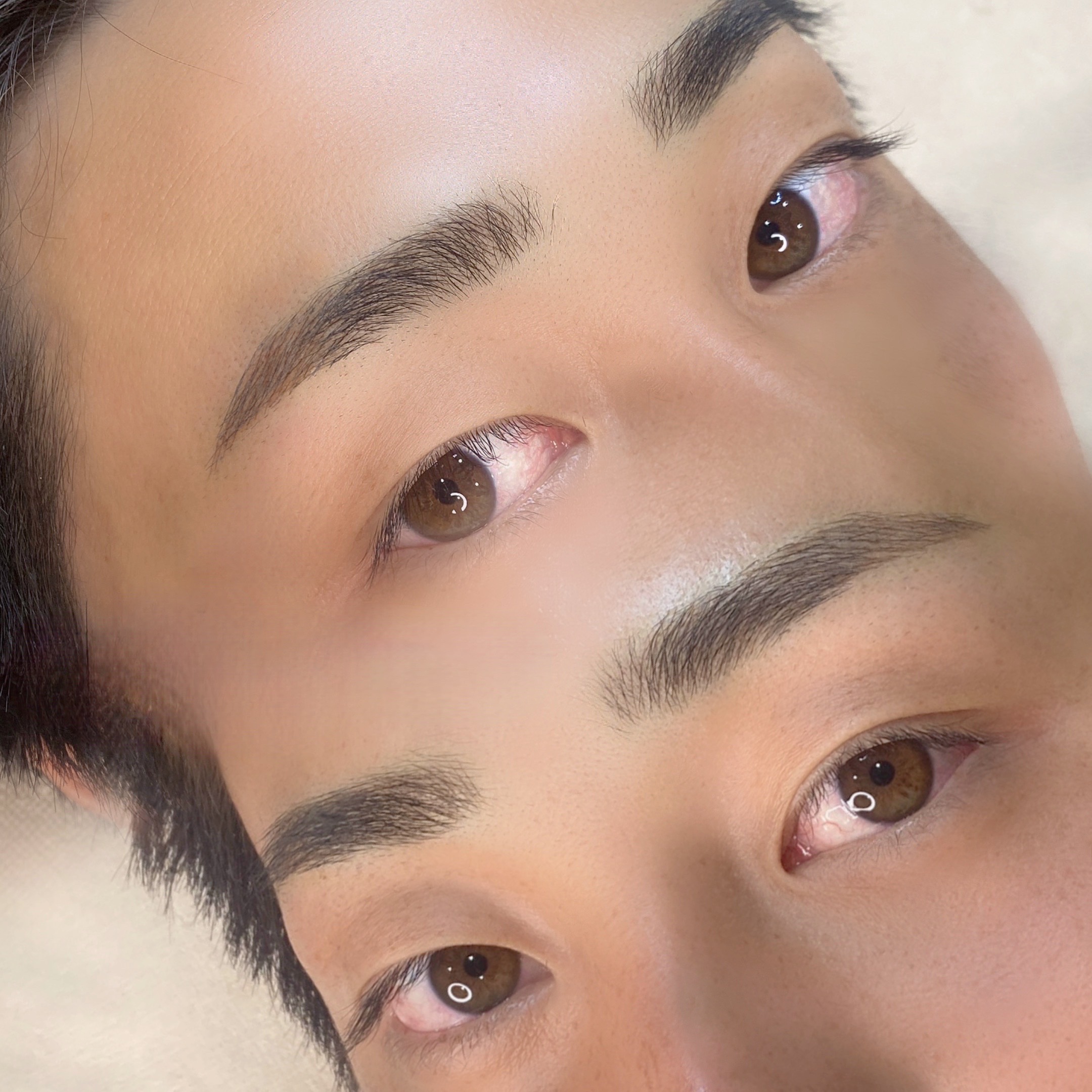 施術事例②
